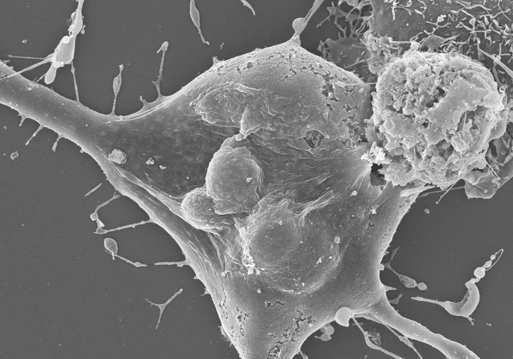 Scientists engineered this human cell to express plant defense proteins called NLRs. Though the human cell doesn’t contain any other components of the plant immune system, NLRs alone can still trigger cell death. Credit: Pierre Jacob
