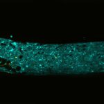 Photo of Adult C. elegans gonad expressing fluorescent proteins in the distal tip cell (yellow) and somatic gonad sheath cells (cyan).