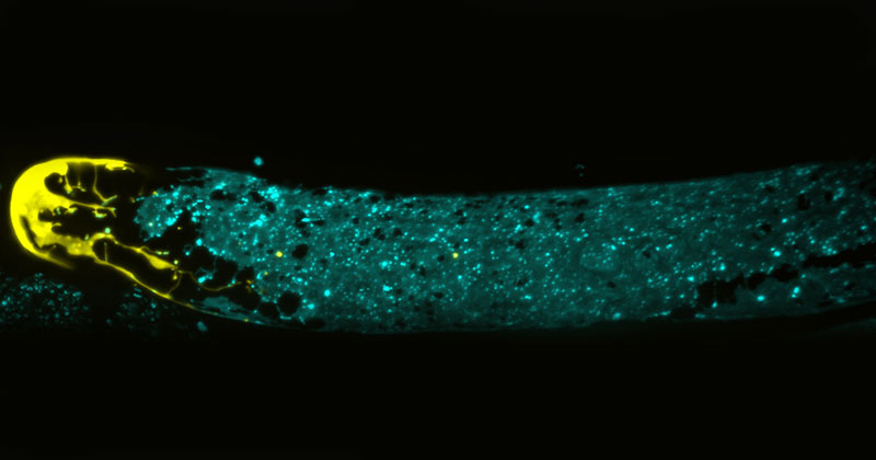 Photo of Adult C. elegans gonad expressing fluorescent proteins in the distal tip cell (yellow) and somatic gonad sheath cells (cyan).