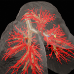 A colorful X ray shows the tissues of the lungs.